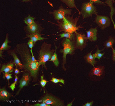 HDAC4鼠单克隆抗体
