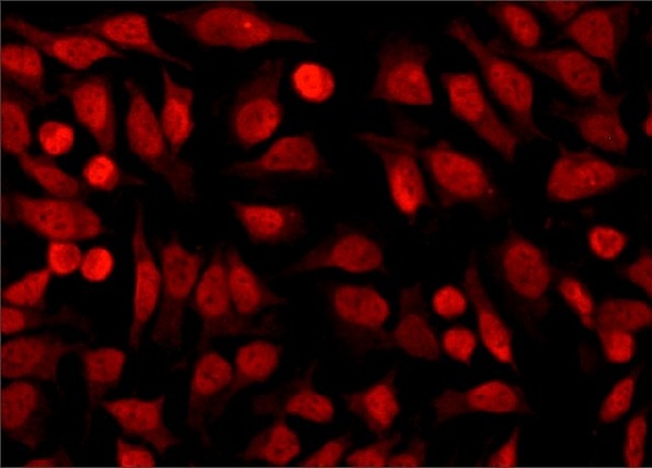 HDAC1 多克隆抗体
