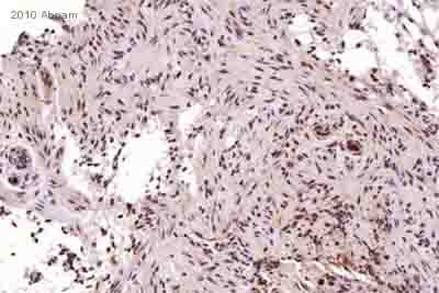 兔抗MGMT多克隆抗体
