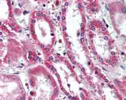 SIRT5 兔单克隆抗体