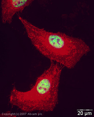 兔抗CDK9多克隆抗体