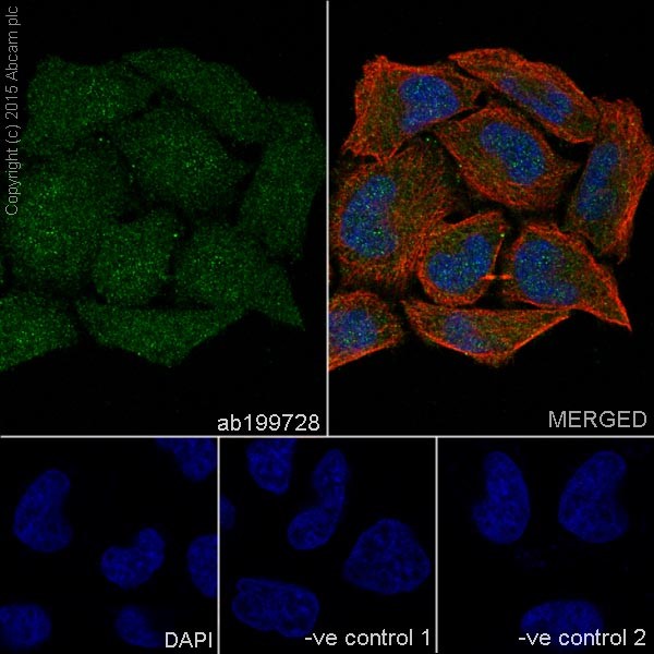 CDK4抗体(小鼠单抗)