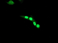 HDAC7 兔单克隆抗体