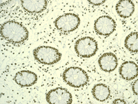 HDAC7 兔单克隆抗体