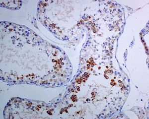 TACC3 兔单克隆抗体