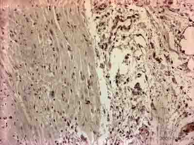 兔抗S100A4多克隆抗体