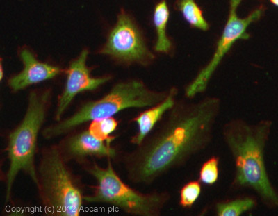 兔抗S100A4多克隆抗体