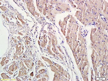 兔抗ROCK1多克隆抗体