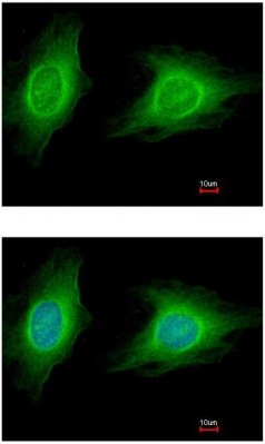 ROCK1 兔多克隆抗体