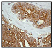 RADIXIN 兔单克隆抗体