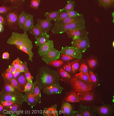 RADIXIN 兔单克隆抗体