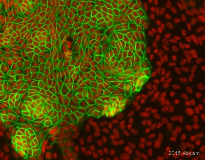 E-CADHERIN 小鼠单克隆抗体