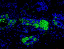 EPCAM 小鼠单克隆抗体