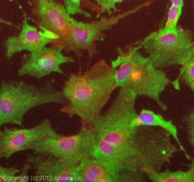 EPCAM 小鼠单克隆抗体