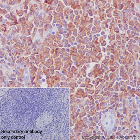P16 ARC 兔单克隆抗体