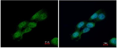 兔抗CDC23多克隆抗体
