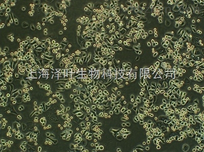 AE-2 小鼠杂交瘤细胞(抗ACHE)