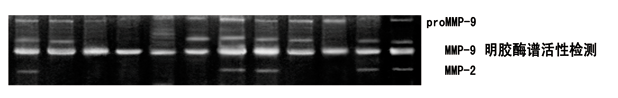 明胶酶谱MMP(2/9)