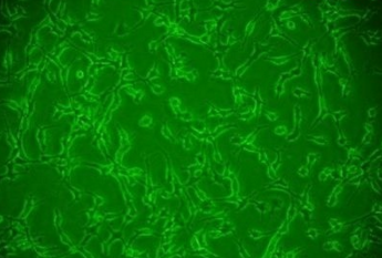 Chang liver/人张氏肝细胞