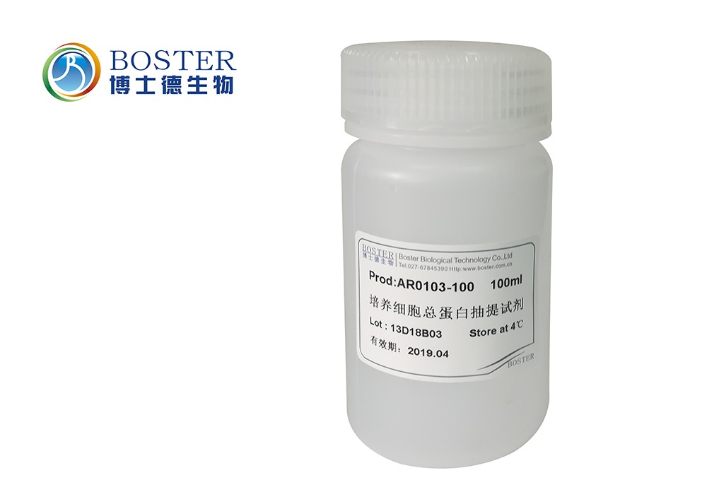 培养细胞总蛋白抽提试剂