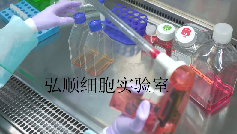 NIT-1细胞：小鼠胰腺β细胞