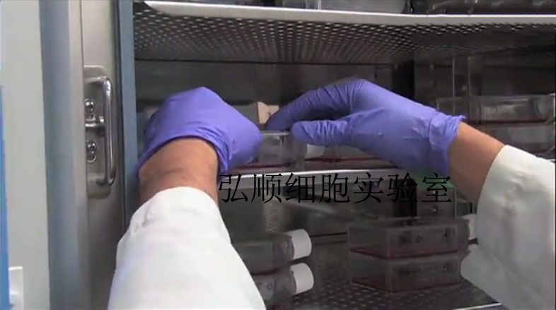 ATN-1细胞：人T细胞白血病细胞