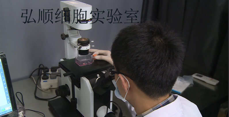 CHL细胞：中国仓鼠肺细胞