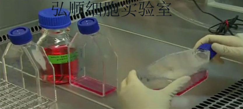 HPASMC细胞：人肺动脉平滑肌细胞