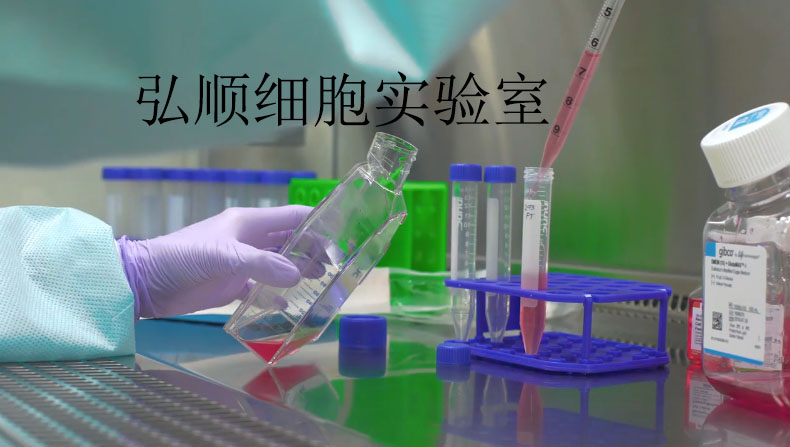 T1-73细胞：人骨肉瘤细胞