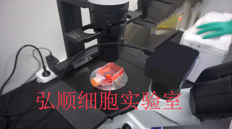 ZR-75-1细胞：人乳腺导管癌细胞
