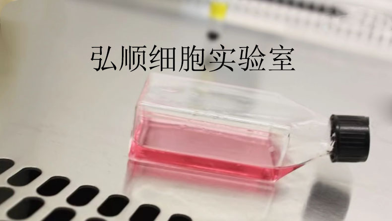 NCI-H1618细胞：人小细胞肺癌细胞