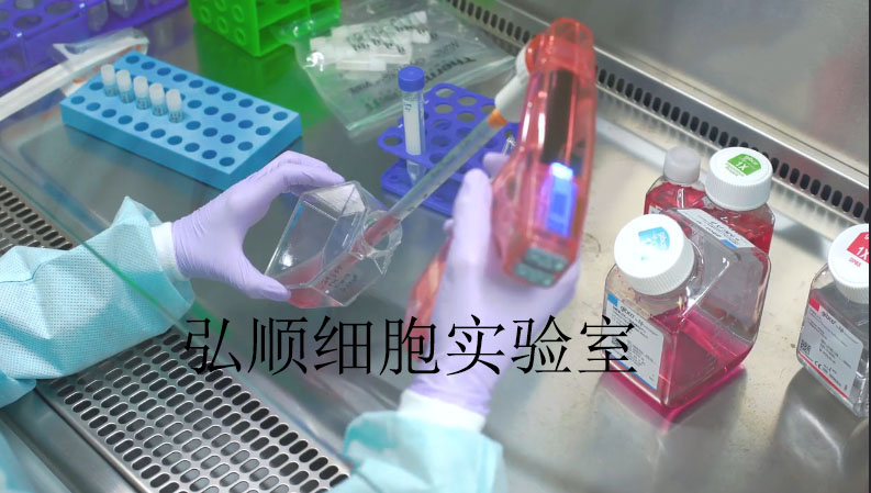 NCTC1469[NCTC1469][小鼠正常肝细胞]