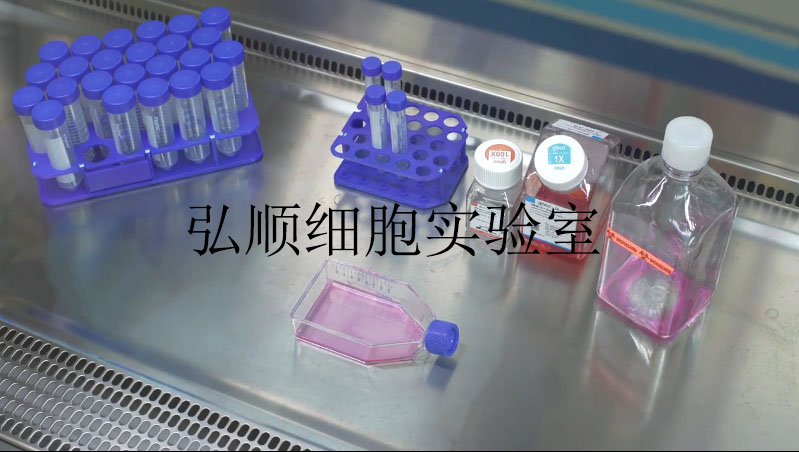NCI-h1688 Cell Line|人经典小细胞肺癌细胞