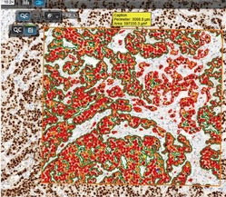 数字病理图片分析服务