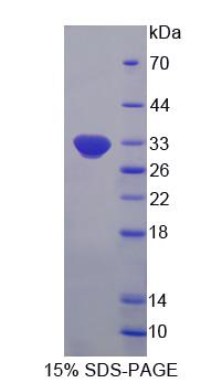 2',5'-寡腺苷酸合成酶样蛋白(OASL)重组蛋白