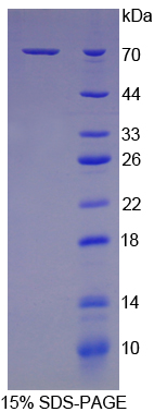 70kDa热休克蛋白1B(HSPA1B)重组蛋白