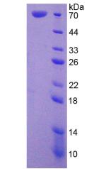 70kDa热休克蛋白1样蛋白(HSPA1L)重组蛋白