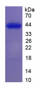 7-脱氢胆固醇还原酶(DHCR7)重组蛋白