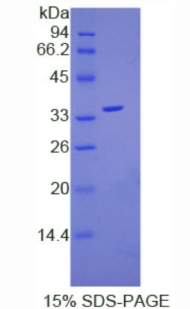 Ⅰ类主要组织相容性复合体C(MHCC)重组蛋白