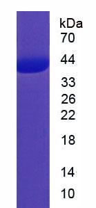 Ⅰ类主要组织相容性复合体E(MHCE)重组蛋白