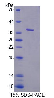 Asc型氨基酸转运蛋白1(ASC1)重组蛋白