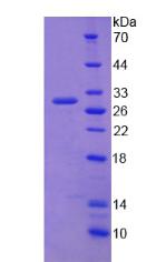 ATP结合盒转运蛋白C2(ABCC2)重组蛋白