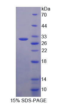 ATP结合盒转运蛋白C3(ABCC3)重组蛋白