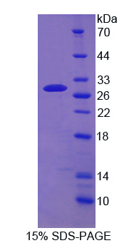 ATP结合盒转运蛋白C4(ABCC4)重组蛋白