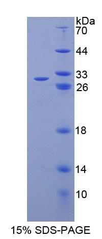ATP结合盒转运蛋白C6(ABCC6)重组蛋白