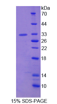 ATP结合盒转运蛋白C8(ABCC8)重组蛋白