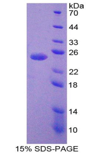 ATP依赖性DNA连接酶Ⅰ(LIG1)重组蛋白
