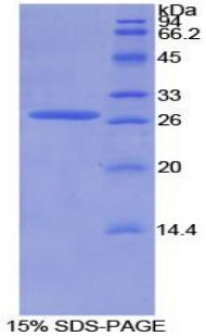 Axis抑制蛋白(AXIN)重组蛋白