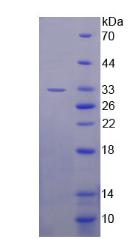B-细胞淋巴瘤因子11A(Bcl11A)重组蛋白