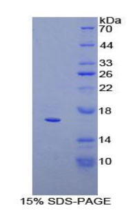 CD160分子(CD160)重组蛋白
